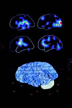 Marjorie Taylor Quilted Brains, 2006